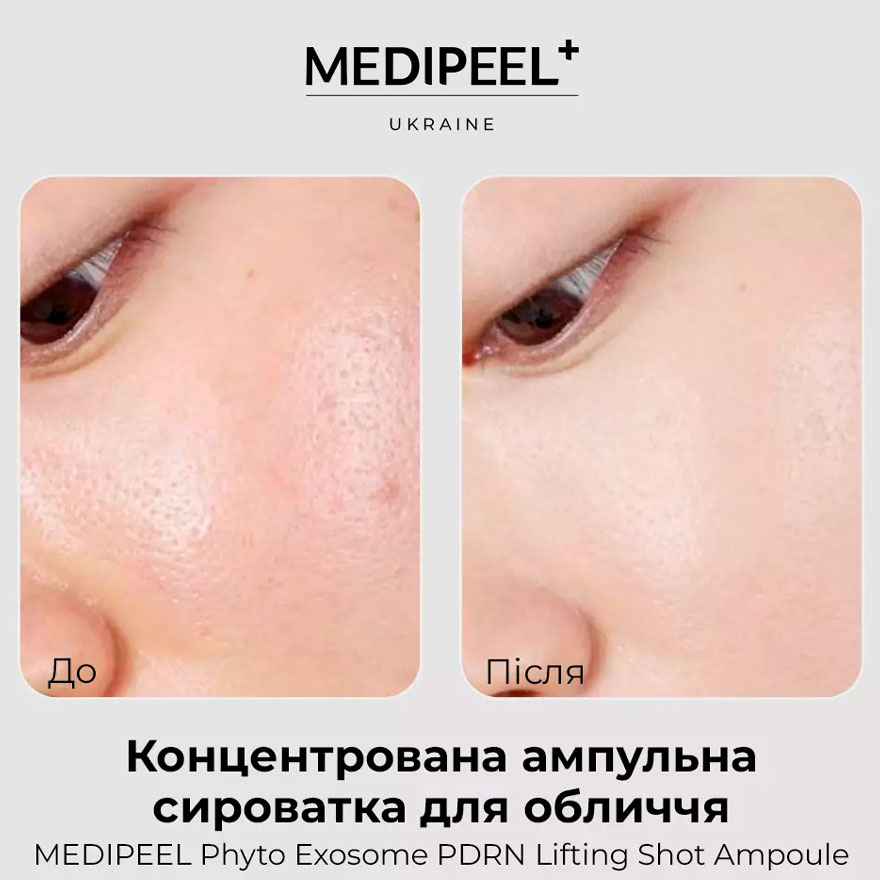 MEDI-PEEL Сироватка для обличчя ампульна Phyto Exosome PDRN Lifting Shot Ampoule, 100 мл