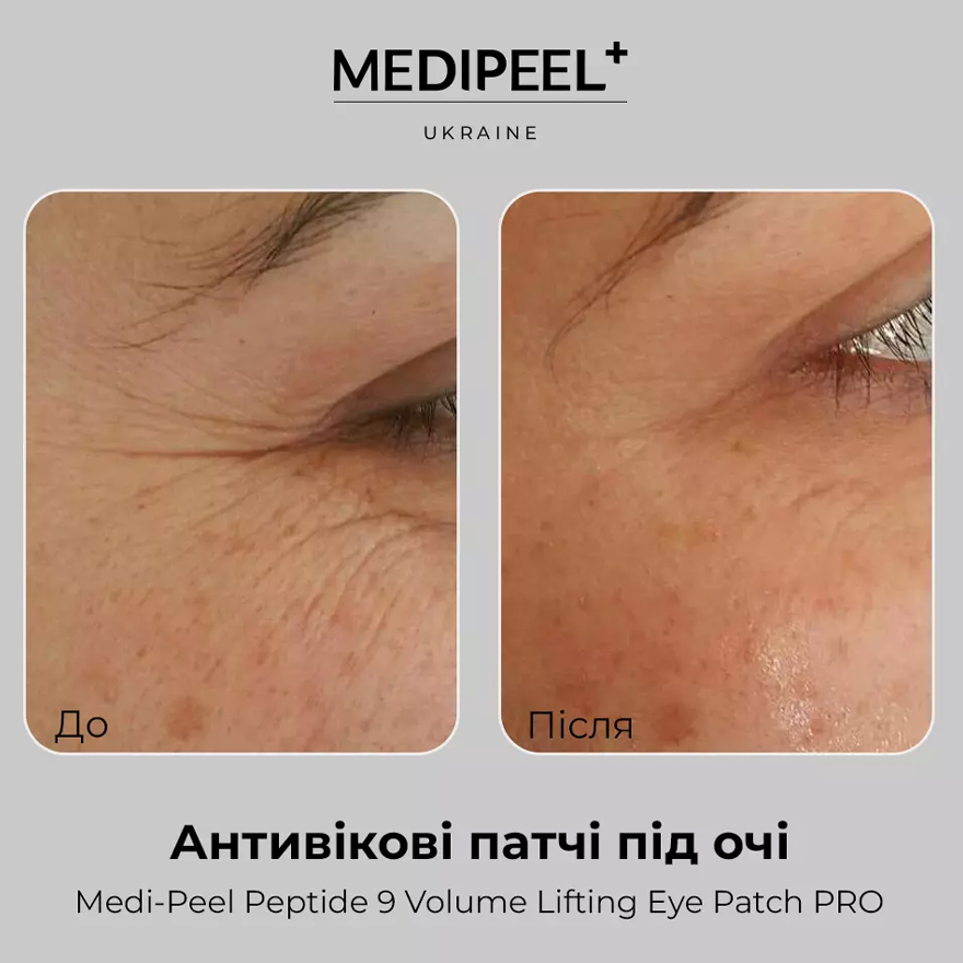 MEDI-PEEL Lifting eye patches with peptides Peptide 9 Volume Lifting Eye Patch Pro, 60 pcs