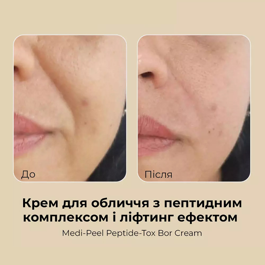 Medi-Peel Peptide-Tox Bor Cream-lifting with peptide complex, 50 ml Medi-Peel Peptide-Tox Bor Cream-lifting with peptide complex, 50 ml