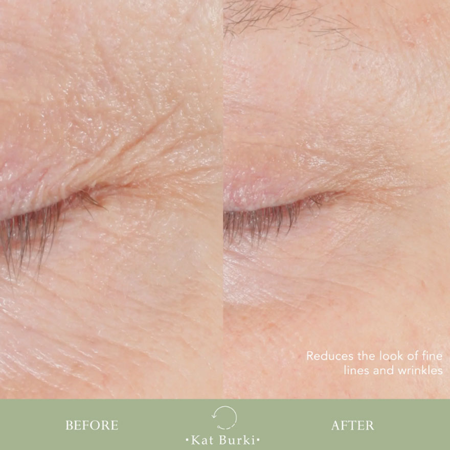 Kat Burki Reversal Lift & Fill Form Control Marine Collagen Gel, 30 ml