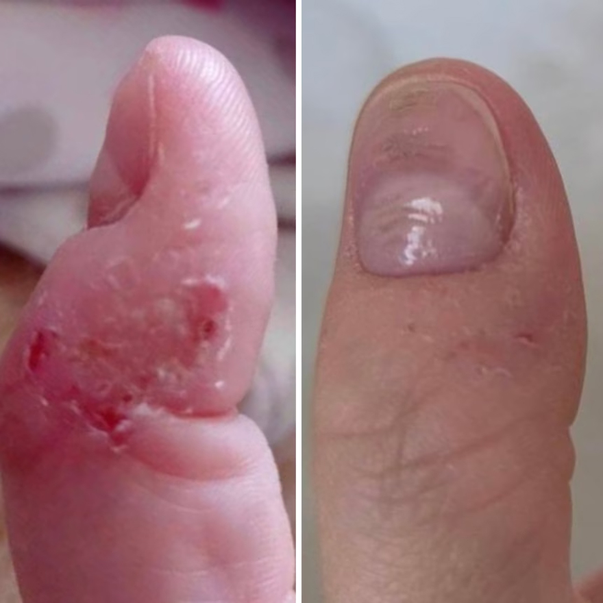 Resultum крем-тальк для рук та стоп Soleverum Cream, 100 мл