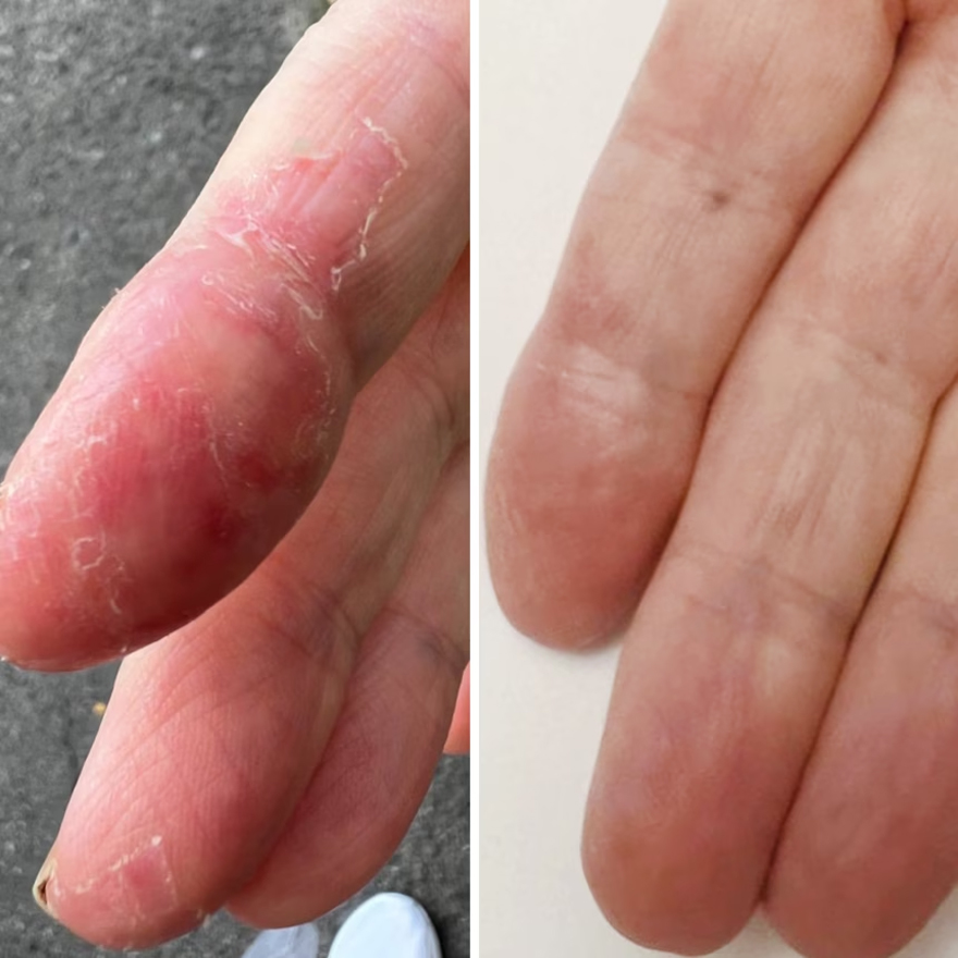 Resultum крем-тальк для рук та стоп Soleverum Cream, 100 мл