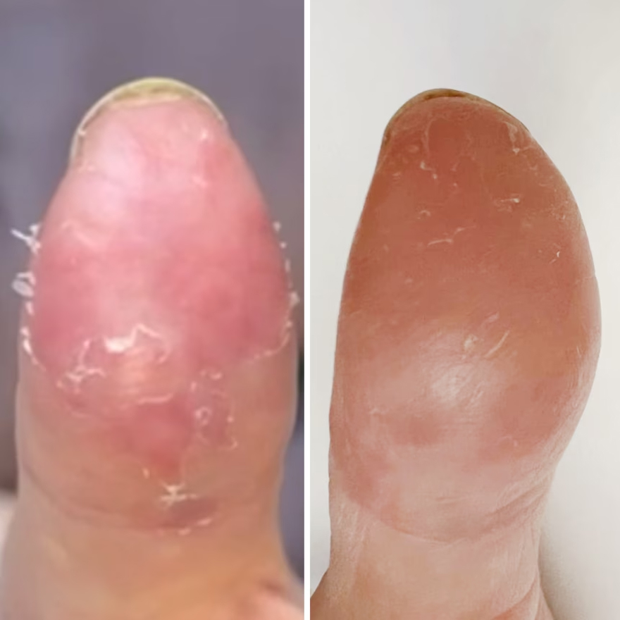 Resultum крем-тальк для рук та стоп Soleverum Cream, 100 мл