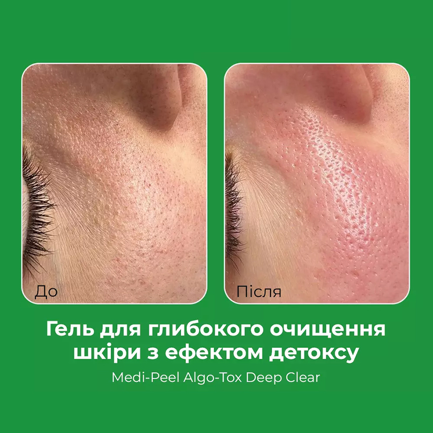 MEDI-PEEL Algo-Tox Deep Clear, Гель для глибокого очищення з ефектом Детокс, 150 мл