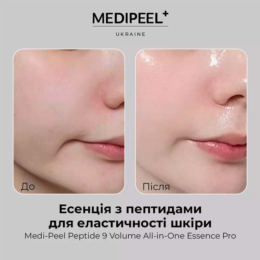 MEDI-PEEL Есенція киснева з пептидами для обличчя Peptide 9 Volume All In One Essence Pro, 100 мл MEDI-PEEL Есенція киснева з пептидами для обличчя Peptide 9 Volume All In One Essence Pro, 100 мл