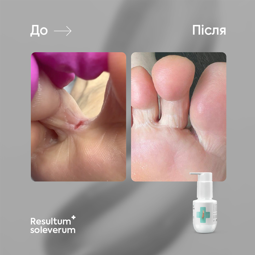 Resultum мыло для стоп Soleverum, 75 мл