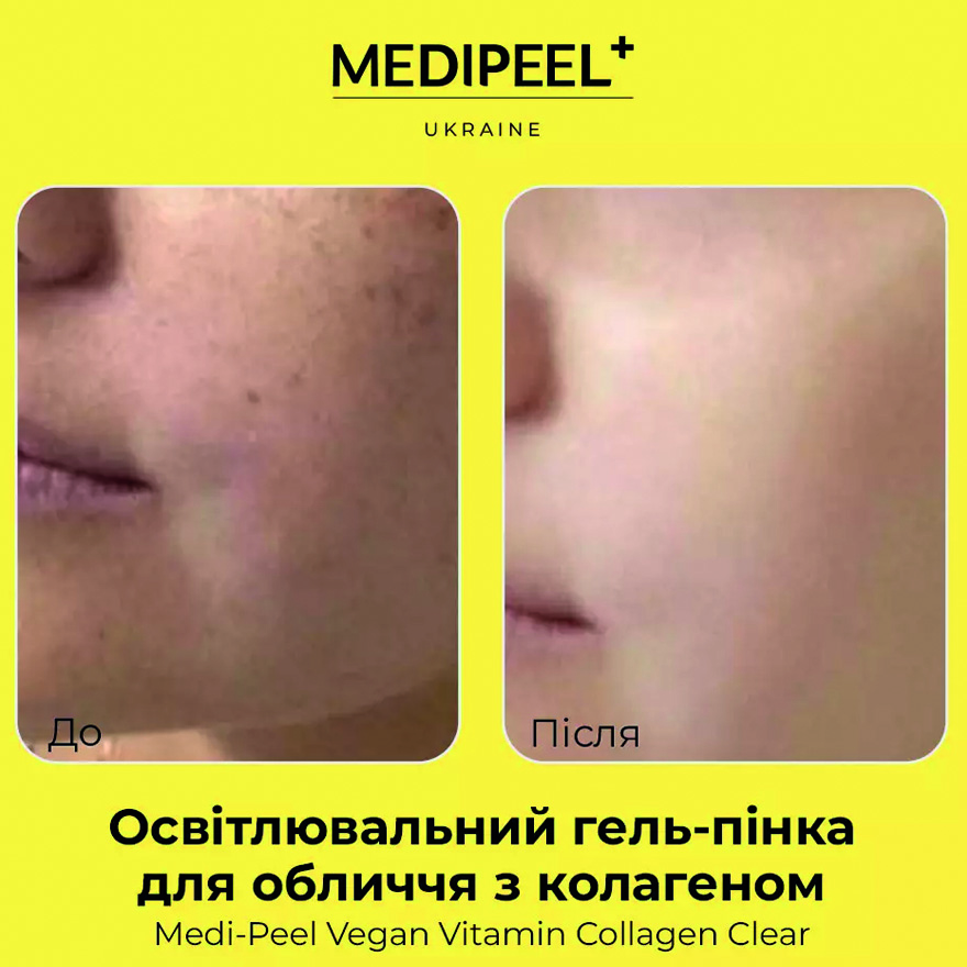 УЦІНКА до 10.2026 MEDI-PEEL Гель-пінка очищаюча для обличчя з екстрактом лимона та колагеном Vegan Vitamin Collagen Clear, 120 мл