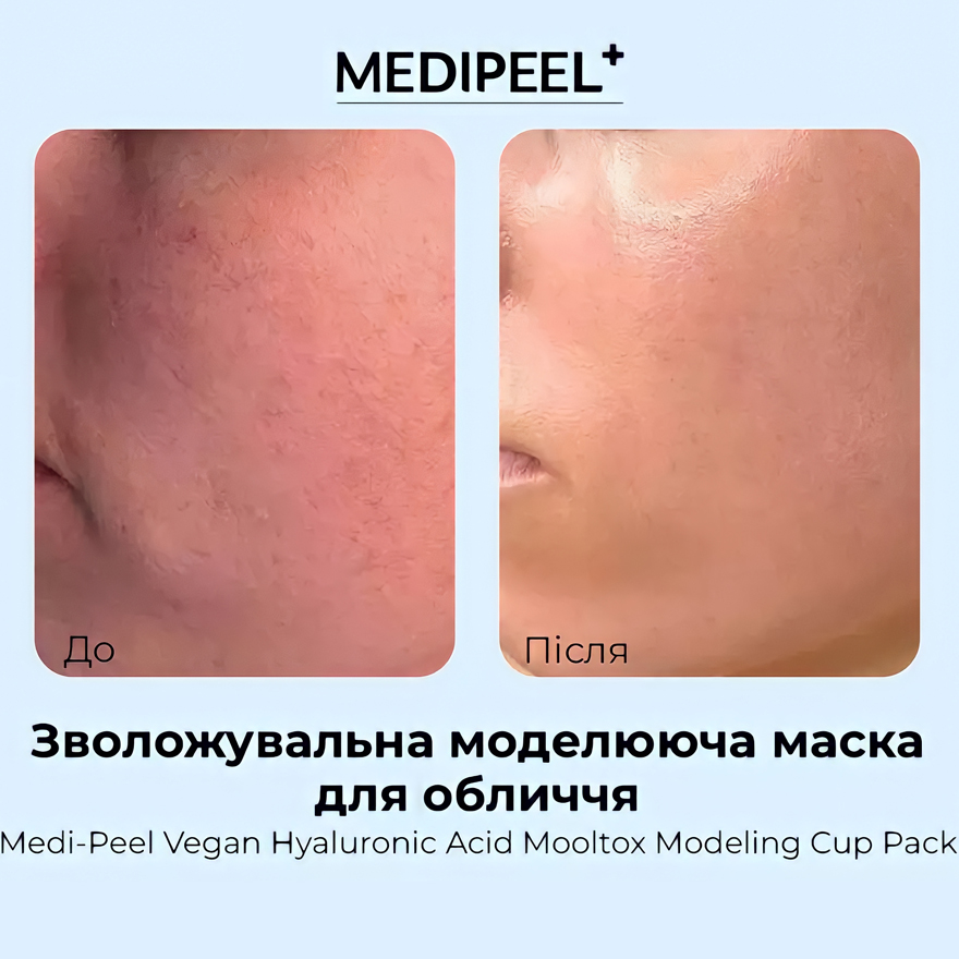 MEDI-PEEL Modeling mask for facial skin Vegan Hyaluronic Acid Mooltox Modeling Cup Pack, 28 g