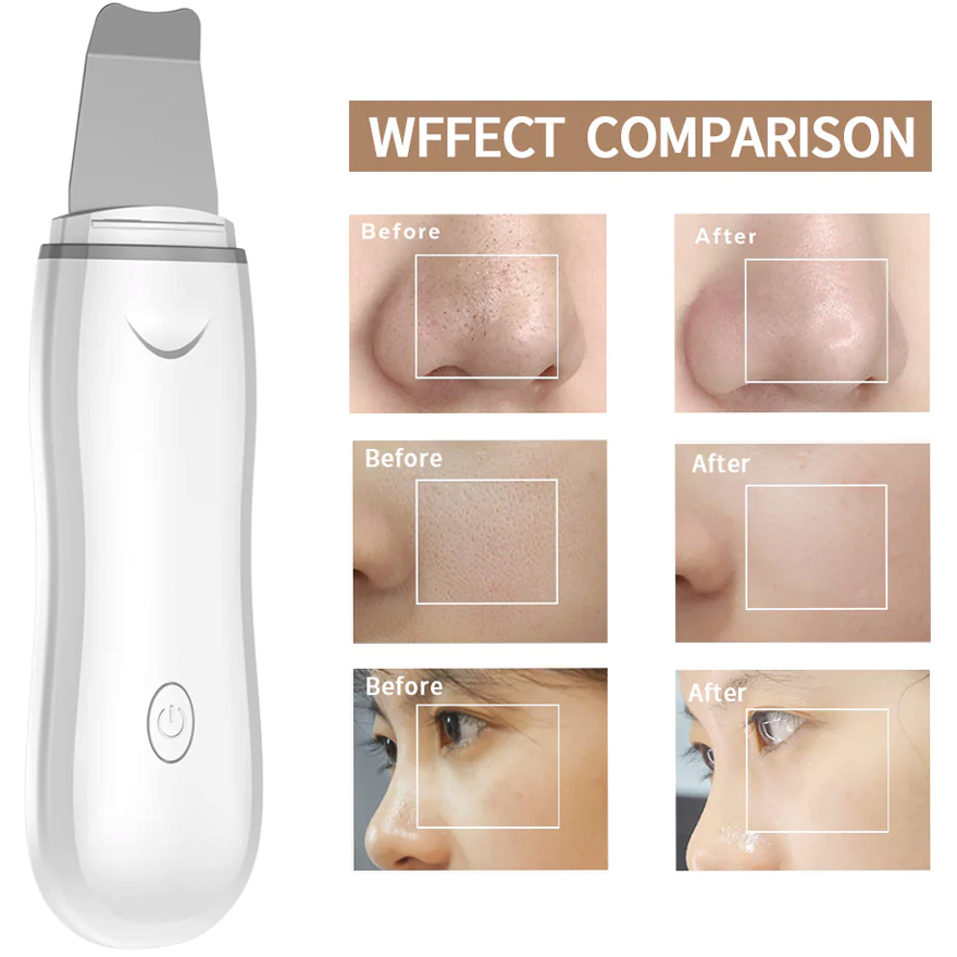 Ultrasonic scrubber KKS Beauty Facial Skin Scrubber, white