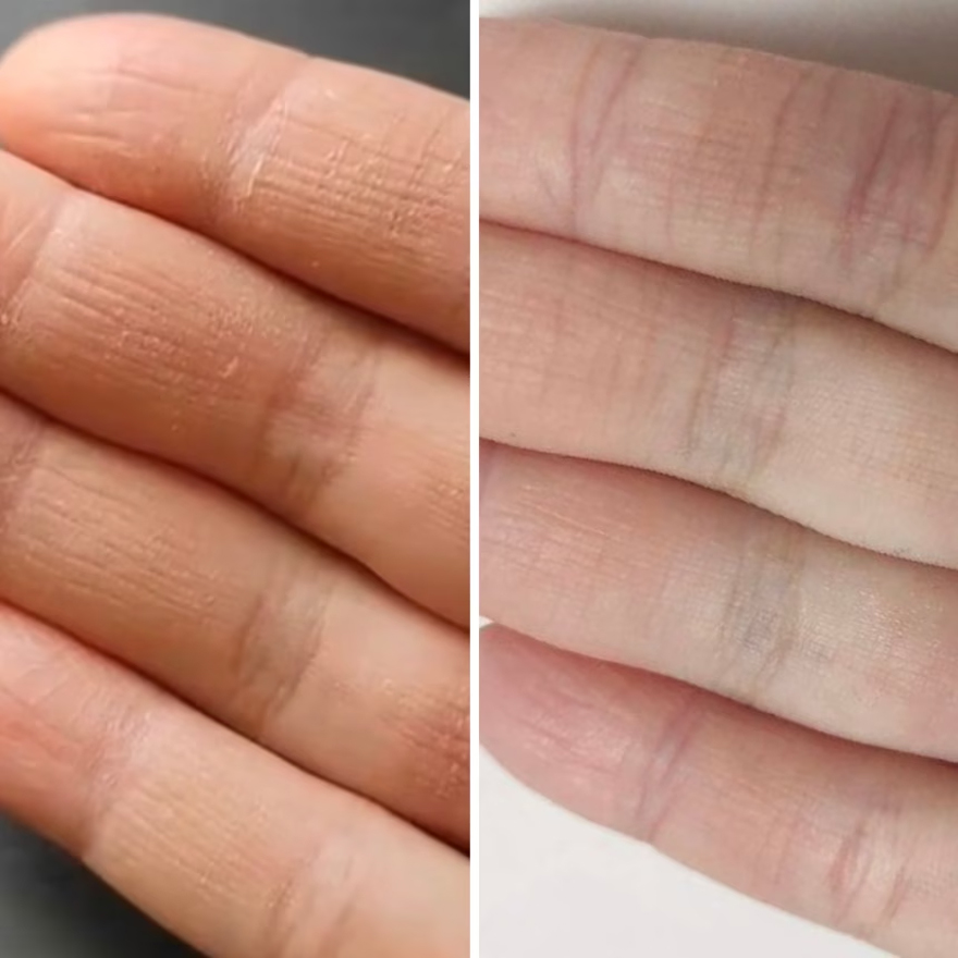 Resultum крем-тальк для рук та стоп Soleverum Cream, 100 мл