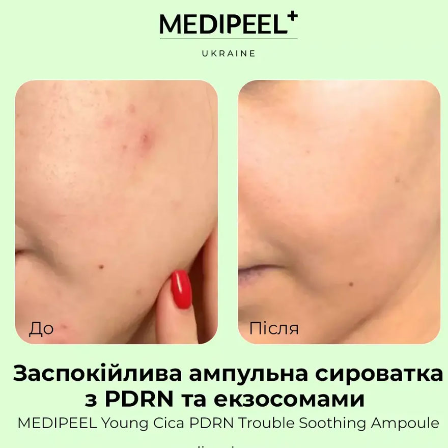 MEDI-PEEL Сироватка заспокійлива з екзосомами та PDRN Young Cica PDRN Trouble Soothing Ampoule, 50 мл