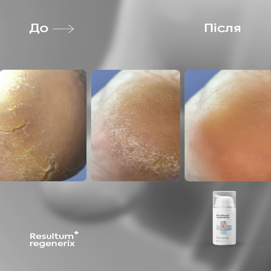 Resultum крем від тріщин для рук і стоп Regenerix, 50 мл Resultum крем від тріщин для рук і стоп Regenerix, 50 мл