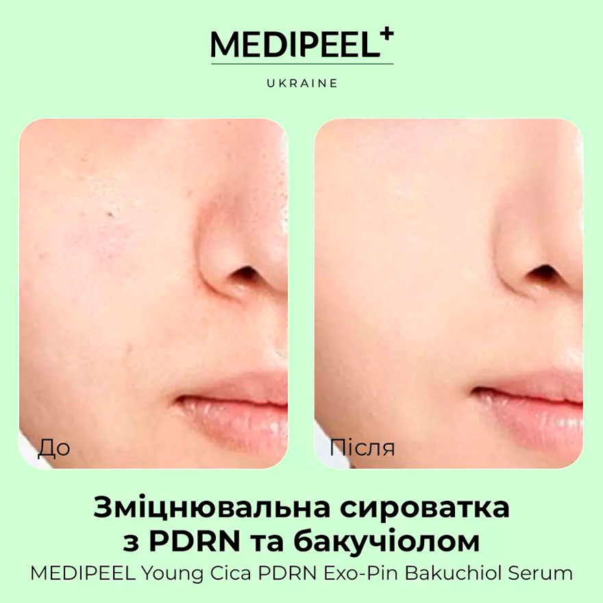 MEDI-PEEL Сироватка зміцнююча з бакучіолом та PDRN Young Cica PDRN Exo-pin Bakuchiol Serum, 50 мл
