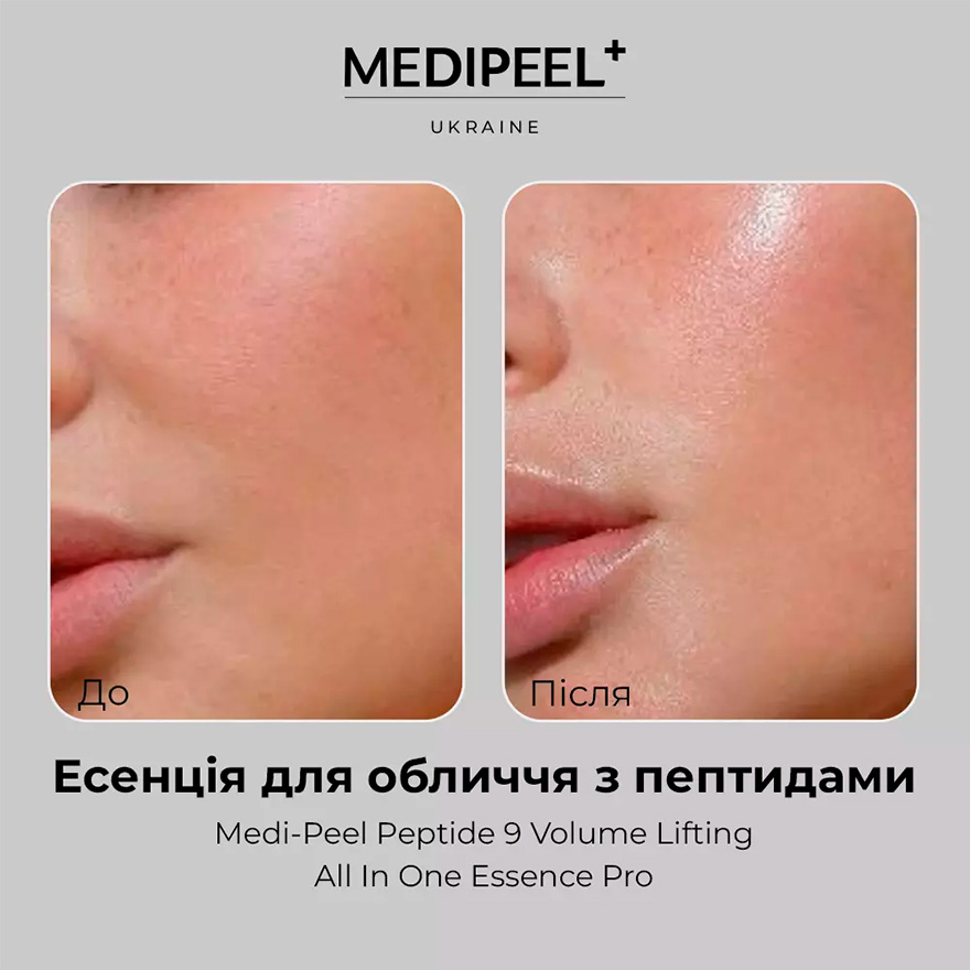 MEDI-PEEL Oxygen lifting essence for the face with peptides Medi-Peel Peptide 9 Volume Lifting All In One Essence Pro, 100 ml
