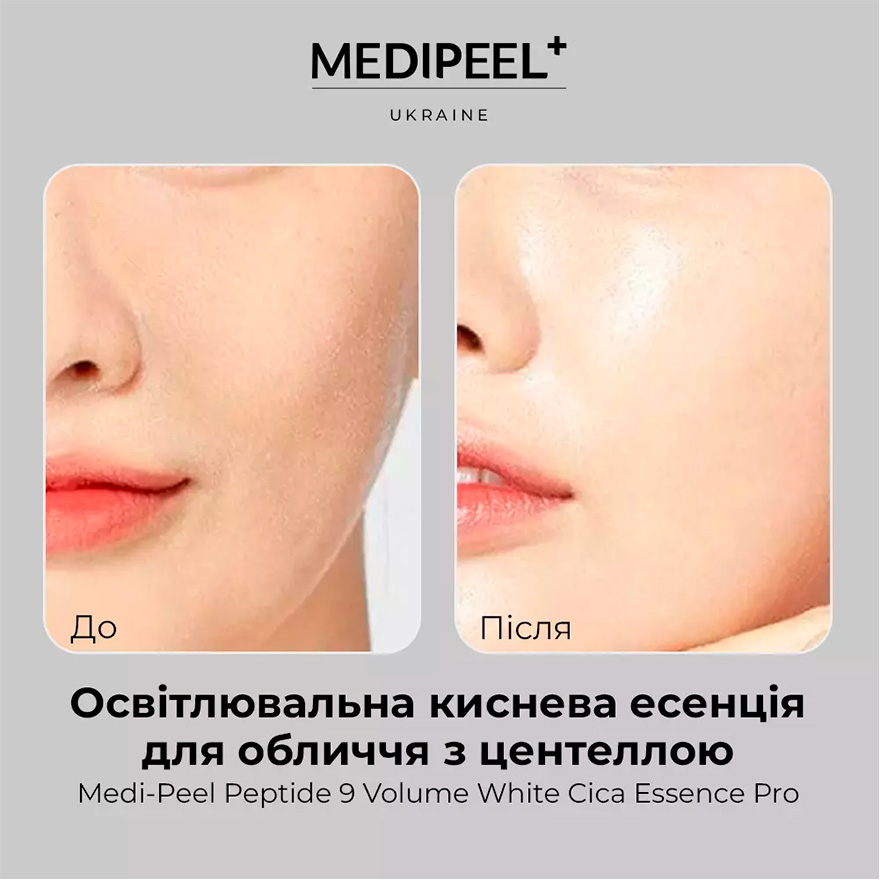 MEDI-PEEL Есенція киснева освітлююча для обличчя з центеллою Peptide 9 Volume All In One White Cica Essence Pro, 100 мл MEDI-PEEL Есенція киснева освітлююча для обличчя з центеллою Peptide 9 Volume All In One White Cica Essence Pro, 100 мл