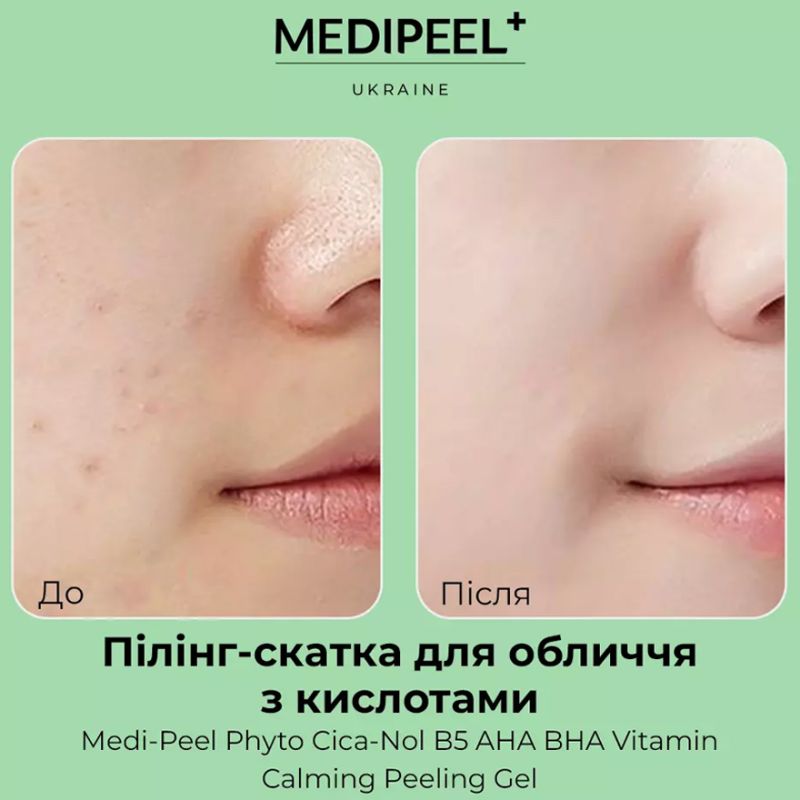 УЦЕНКА до 10.2026 MEDI-PEEL Пилинг-гель успокаивающий витаминный для лица Phyto Cica-Nol B5 AHA BHA Vitamin Calming Peeling Gel, 120 мл
