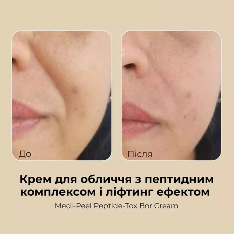 Medi-Peel Peptide-Tox Bor Cream-lifting with peptide complex, 50 ml