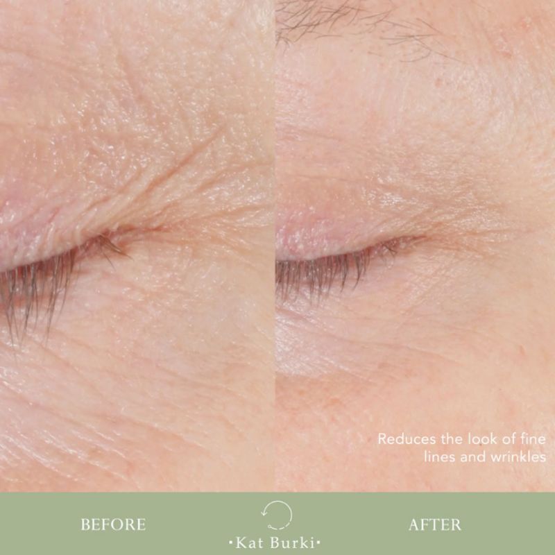 Kat Burki Reversal Lift & Fill Form Control Marine Collagen Gel, 30 ml