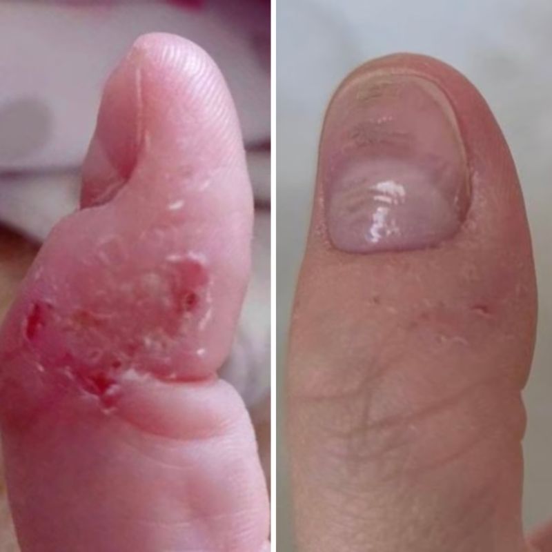 Resultum крем-тальк для рук та стоп Soleverum Cream, 100 мл