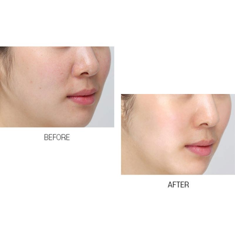 MEDI-PEEL Vitamin Bomb Mask - Refreshing face mask with vitamin complex, 25 ml