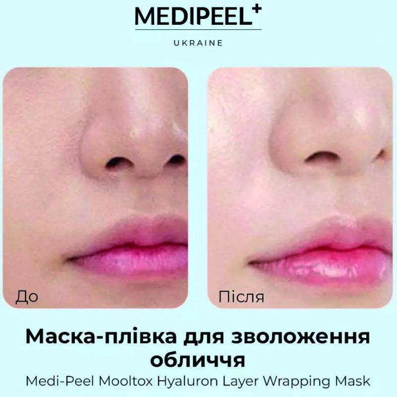 MEDI-PEEL Hyaluronic Acid Layer Mooltox Wrapping Mask, 70 ml