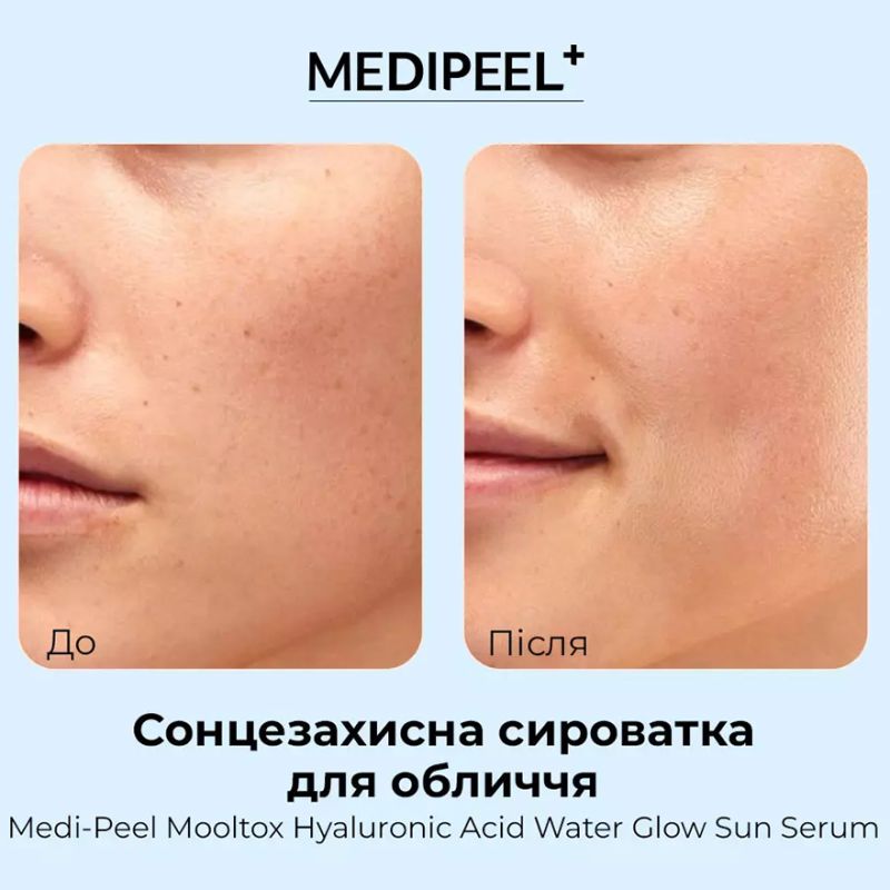 УЦІНКА до 08.2026 MEDI-PEEL Сировотка сонцезахисна зволожуюча для обличчя Hyaluronic Acid Mooltox Water Glow Sun Serum SPF 50+ PA++++, 52 мл
