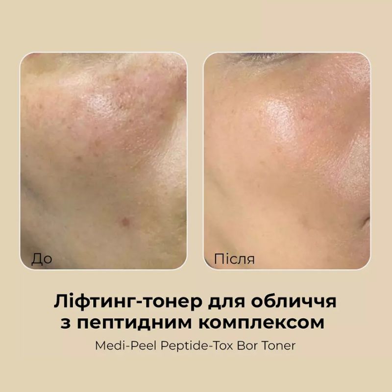 MEDI-PEEL Peptide-Tox Bor Toner Антивозрастной пептидный тонер для лица, 180 мл