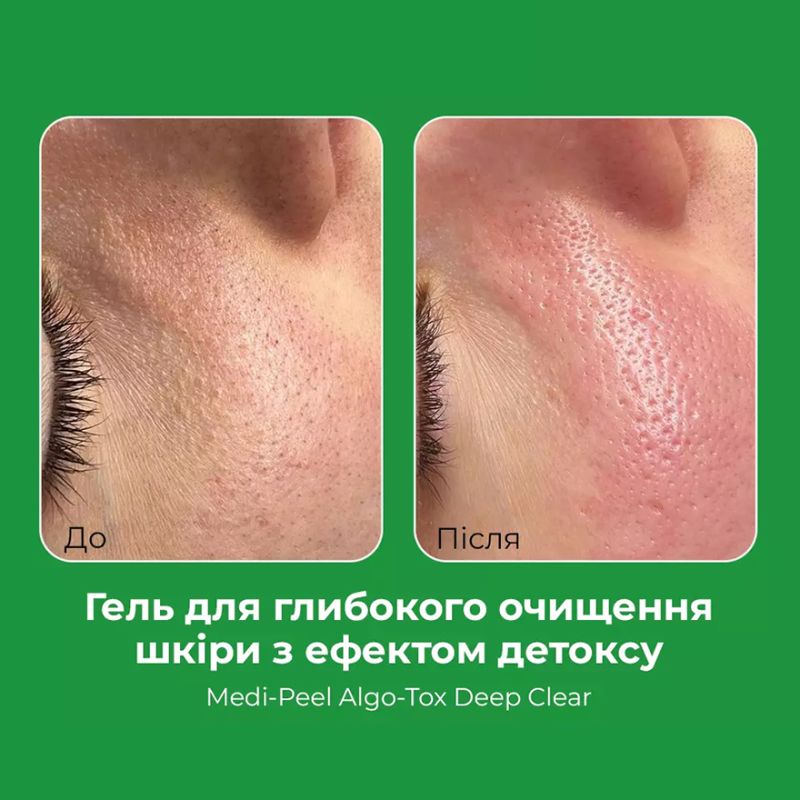 MEDI-PEEL Algo-Tox Deep Clear, Гель для глибокого очищення з ефектом Детокс, 150 мл
