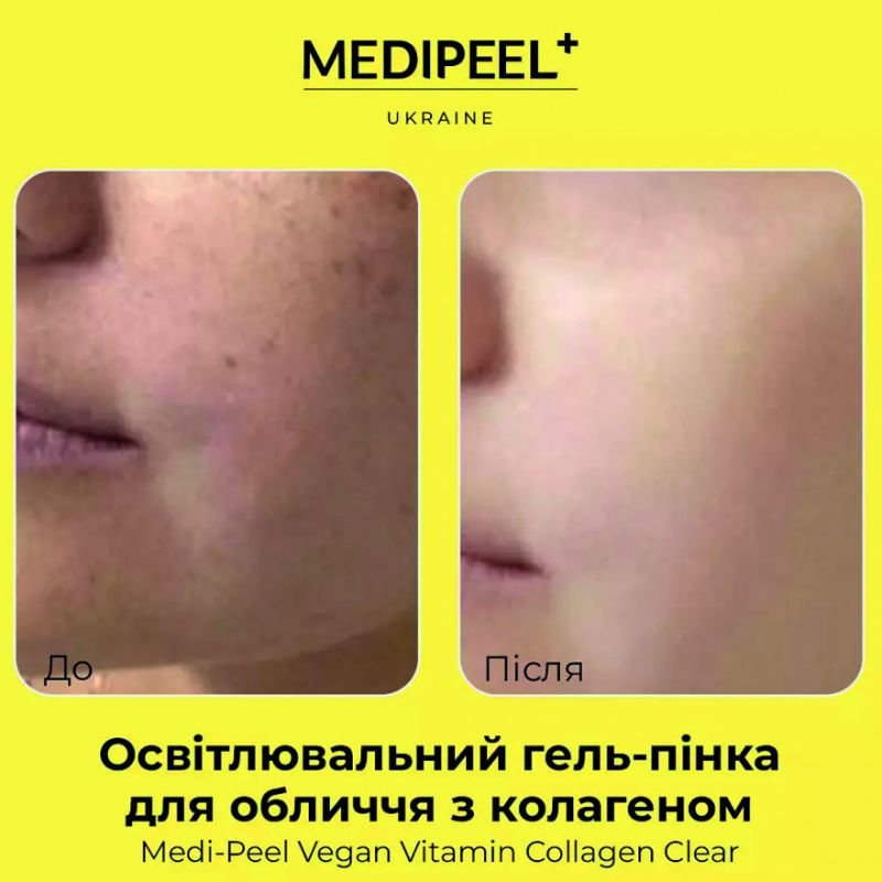 УЦІНКА до 10.2026 MEDI-PEEL Гель-пінка очищаюча для обличчя з екстрактом лимона та колагеном Vegan Vitamin Collagen Clear, 120 мл