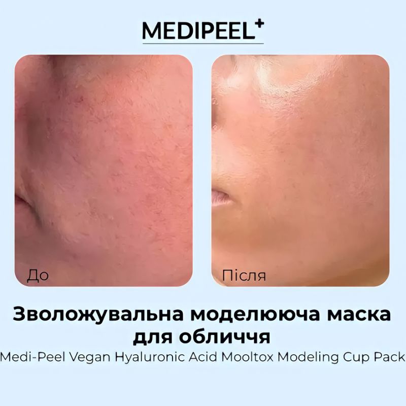 MEDI-PEEL Modeling mask for facial skin Vegan Hyaluronic Acid Mooltox Modeling Cup Pack, 28 g