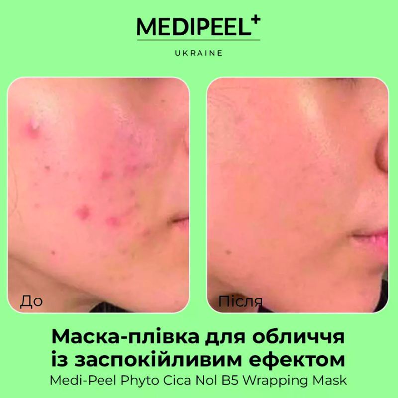 MEDI-PEEL Film mask with a calming effect for the face Phyto Cica-Nol B5 Calming Vegan Wrapping Mask, 70 ml