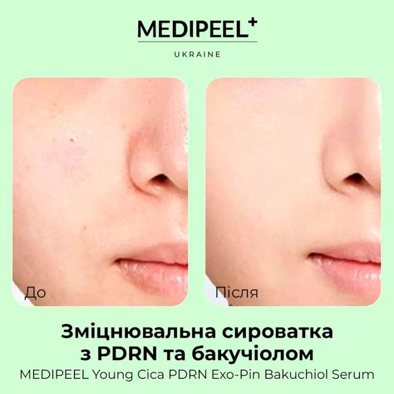 MEDI-PEEL Сироватка зміцнююча з бакучіолом та PDRN Young Cica PDRN Exo-pin Bakuchiol Serum, 50 мл