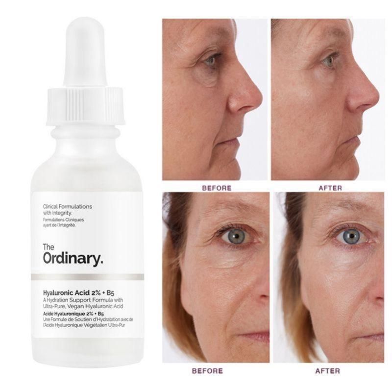 The Ordinary Hyaluronic Acid 2% + B5 - Serum with hyaluronic acid, 30 ml