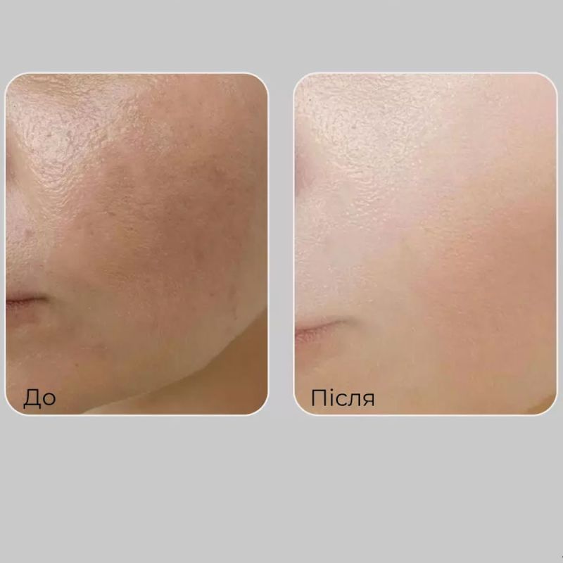 MEDI-PEEL Крем для обличчя з пептидами та вітамінним комплексом Peptide 9 Vitanol Cream Pro, 50 мл