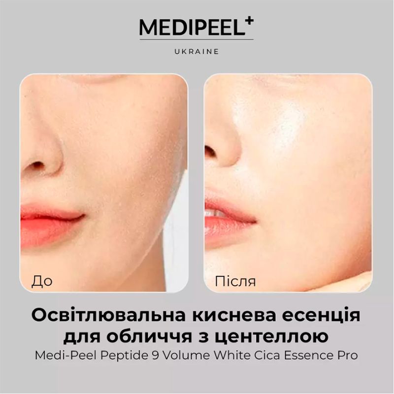 MEDI-PEEL Есенція киснева освітлююча для обличчя з центеллою Peptide 9 Volume All In One White Cica Essence Pro, 100 мл